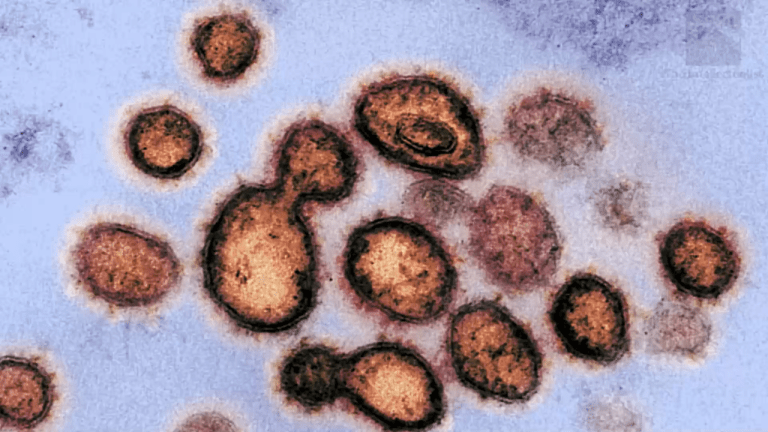 Experts: U.S. Has Missed Window To Contain Coronavirus